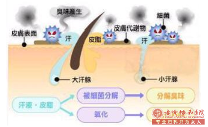 大連林西縣微創(chuàng)治療腋臭的費用是多少