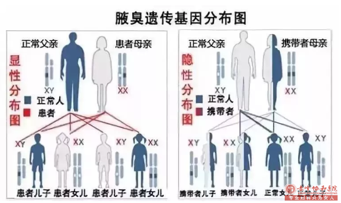 大連紅山區腋毛下有粘稠液體是不是腋臭